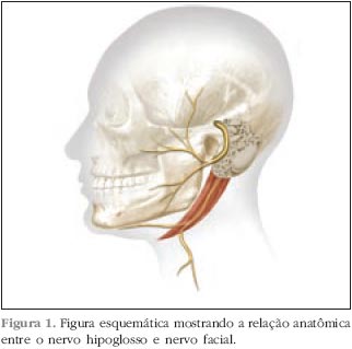 Reanimação do Nervo Facial com Anastomose Hipoglosso Funicular Termino-Terminal